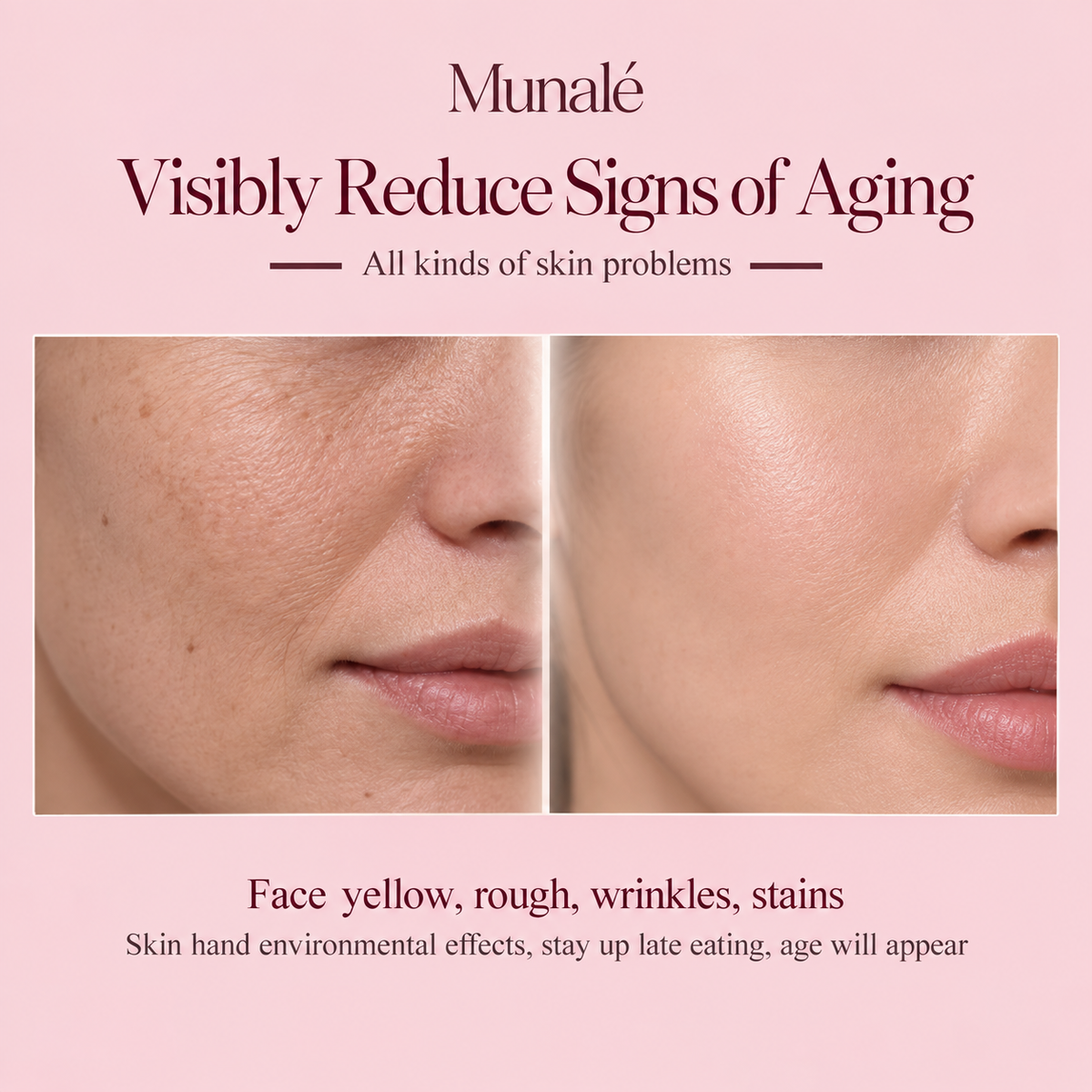Munalé™ PRO DPL Photofacial Skincare Whitening Brightening Anti-ageing Rejuvenation