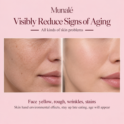 Munalé™ PRO DPL Photofacial Skincare Whitening Brightening Anti-ageing Rejuvenation